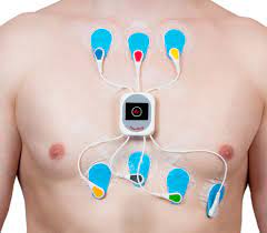 Monitor Holter
